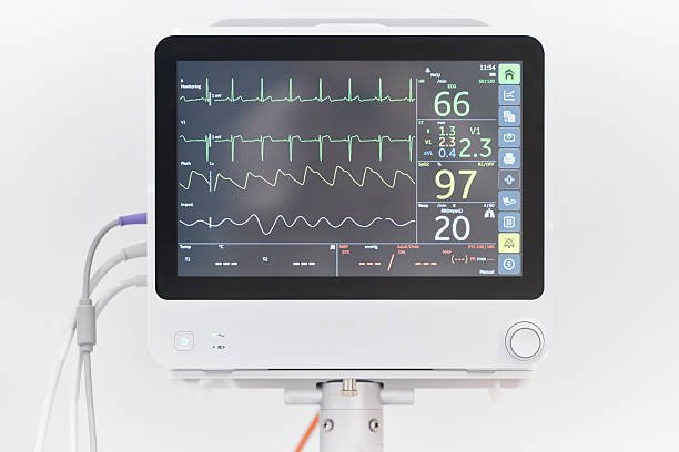ECG monitor displaying a heart rhythm reading